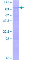 PNKP Protein - 12.5% SDS-PAGE of human PNKP stained with Coomassie Blue