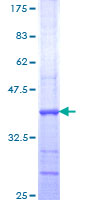 PNKP Protein - 12.5% SDS-PAGE Stained with Coomassie Blue.