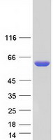 PNKP Protein - Purified recombinant protein PNKP was analyzed by SDS-PAGE gel and Coomassie Blue Staining
