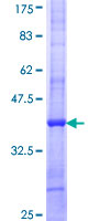 PNLDC1 Protein - 12.5% SDS-PAGE Stained with Coomassie Blue.