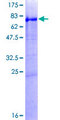 PNLIPRP1 Protein - 12.5% SDS-PAGE of human PNLIPRP1 stained with Coomassie Blue
