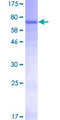 PNLIPRP2 Protein - 12.5% SDS-PAGE of human PNLIPRP2 stained with Coomassie Blue