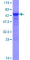 PNMA1 / MA1 Protein - 12.5% SDS-PAGE of human PNMA1 stained with Coomassie Blue