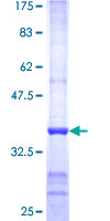 PNMA1 / MA1 Protein - 12.5% SDS-PAGE Stained with Coomassie Blue.