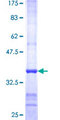 PNMA1 / MA1 Protein - 12.5% SDS-PAGE Stained with Coomassie Blue.