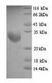 PNMA2 / MA2 Protein - (Tris-Glycine gel) Discontinuous SDS-PAGE (reduced) with 5% enrichment gel and 15% separation gel.