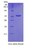 PNMA2 / MA2 Protein - Recombinant Paraneoplastic Antigen MA2 By SDS-PAGE