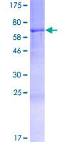PNMA6A Protein - 12.5% SDS-PAGE of human PNMA6A stained with Coomassie Blue