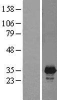 PNMT Protein - Western validation with an anti-DDK antibody * L: Control HEK293 lysate R: Over-expression lysate