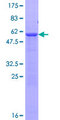 PNMT Protein - 12.5% SDS-PAGE of human PNMT stained with Coomassie Blue
