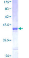 PNMT Protein - 12.5% SDS-PAGE Stained with Coomassie Blue.