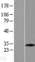 PNO1 Protein - Western validation with an anti-DDK antibody * L: Control HEK293 lysate R: Over-expression lysate