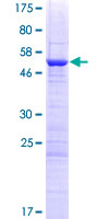 PNO1 Protein - 12.5% SDS-PAGE of human PNO1 stained with Coomassie Blue