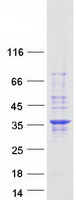 PNO1 Protein - Purified recombinant protein PNO1 was analyzed by SDS-PAGE gel and Coomassie Blue Staining