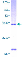 PNOC / Nociceptin Protein - 12.5% SDS-PAGE of human PNOC stained with Coomassie Blue