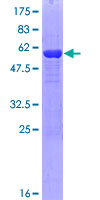 PNP / Nucleoside Phosphorylase Protein - 12.5% SDS-PAGE of human NP stained with Coomassie Blue