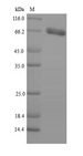 PNPLA2 / ATGL Protein - (Tris-Glycine gel) Discontinuous SDS-PAGE (reduced) with 5% enrichment gel and 15% separation gel.