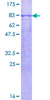 PNPLA2 / ATGL Protein - 12.5% SDS-PAGE of human PNPLA2 stained with Coomassie Blue