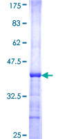 PNPLA2 / ATGL Protein - 12.5% SDS-PAGE Stained with Coomassie Blue.