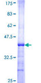 PNPLA2 / ATGL Protein - 12.5% SDS-PAGE Stained with Coomassie Blue.