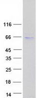 PNPLA2 / ATGL Protein - Purified recombinant protein PNPLA2 was analyzed by SDS-PAGE gel and Coomassie Blue Staining