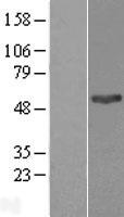 PNPLA3 / Adiponutrin Protein - Western validation with an anti-DDK antibody * L: Control HEK293 lysate R: Over-expression lysate