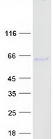 PNPLA3 / Adiponutrin Protein - Purified recombinant protein PNPLA3 was analyzed by SDS-PAGE gel and Coomassie Blue Staining