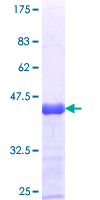 PNPLA6 / NTE Protein - 12.5% SDS-PAGE Stained with Coomassie Blue.