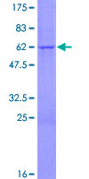 PNPO Protein - 12.5% SDS-PAGE of human PNPO stained with Coomassie Blue