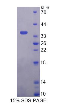 PNPO Protein - Recombinant Pyridoxamine-5'-Phosphate Oxidase By SDS-PAGE