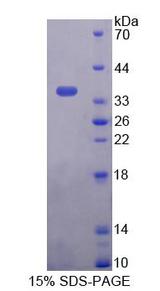 PNPO Protein - Recombinant Pyridoxamine-5'-Phosphate Oxidase By SDS-PAGE