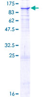 PNPT1 Protein - 12.5% SDS-PAGE of human PNPT1 stained with Coomassie Blue