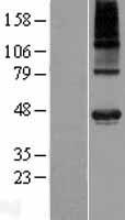 POC1A / SOFT Protein - Western validation with an anti-DDK antibody * L: Control HEK293 lysate R: Over-expression lysate