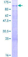 PODN Protein - 12.5% SDS-PAGE of human PODN stained with Coomassie Blue