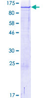 PODXL2 / Endoglycan Protein - 12.5% SDS-PAGE of human PODXL2 stained with Coomassie Blue