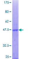 POFUT1 Protein - 12.5% SDS-PAGE of human POFUT1 stained with Coomassie Blue