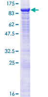 POGK Protein - 12.5% SDS-PAGE of human POGK stained with Coomassie Blue