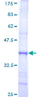 POLA1 / DNA Polymerase Alpha 1 Protein - 12.5% SDS-PAGE Stained with Coomassie Blue.