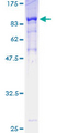 POLA2 / DNA Polymerase Alpha 2 Protein - 12.5% SDS-PAGE of human POLA2 stained with Coomassie Blue