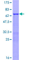 POLB / DNA Polymerase Beta Protein - 12.5% SDS-PAGE of human POLB stained with Coomassie Blue