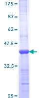 POLB / DNA Polymerase Beta Protein - 12.5% SDS-PAGE Stained with Coomassie Blue.