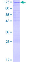 POLD1 Protein - 12.5% SDS-PAGE of human POLD1 stained with Coomassie Blue