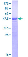 POLD3 Protein - 12.5% SDS-PAGE Stained with Coomassie Blue.