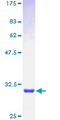 POLD4 Protein - 12.5% SDS-PAGE of human POLD4 stained with Coomassie Blue