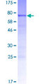 POLDIP3 / p46 Protein - 12.5% SDS-PAGE of human POLDIP3 stained with Coomassie Blue