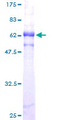 POLE / POLE1 Protein - 12.5% SDS-PAGE of human POLE stained with Coomassie Blue