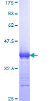 POLE2 Protein - 12.5% SDS-PAGE Stained with Coomassie Blue.