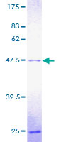 POLE3 / DNA Polymerase Epsilon Protein - 12.5% SDS-PAGE of human POLE3 stained with Coomassie Blue