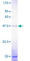 POLE3 / DNA Polymerase Epsilon Protein - 12.5% SDS-PAGE of human POLE3 stained with Coomassie Blue