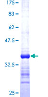 POLE4 / p12 Protein - 12.5% SDS-PAGE Stained with Coomassie Blue